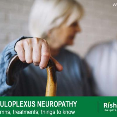 Radiculoplexus neuropathy also known as diabetic amyotrophy is another type of diabetic neuropathy. It affects nerves in the buttocks, hips, thighs, or legs.